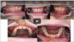 Comment prendre des photos intrabuccales (Orthodontie)